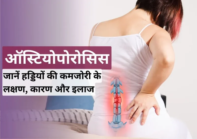 ऑस्टियोपोरोसिस के जोखिम कारक (Osteoporosis Ke Jokhim Karak)