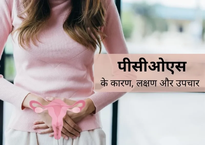 पीसीओएस का इलाज कैसे किया जाता है? (पीसीओएस के इलाज के विभिन्न विकल्पों की हिंदी में जानकारी)