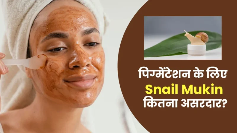 पिगमेंटेशन के लिए प्रभावी उपचार: क्रीम, लेजर थेरेपी, रासायनिक छिलके और घरेलू उपचार