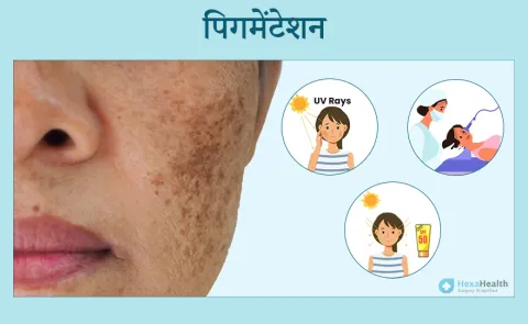 पिगमेंटेशन को रोकने के लिए सुझाव: सनस्क्रीन, स्वस्थ जीवनशैली और त्वचा की देखभाल