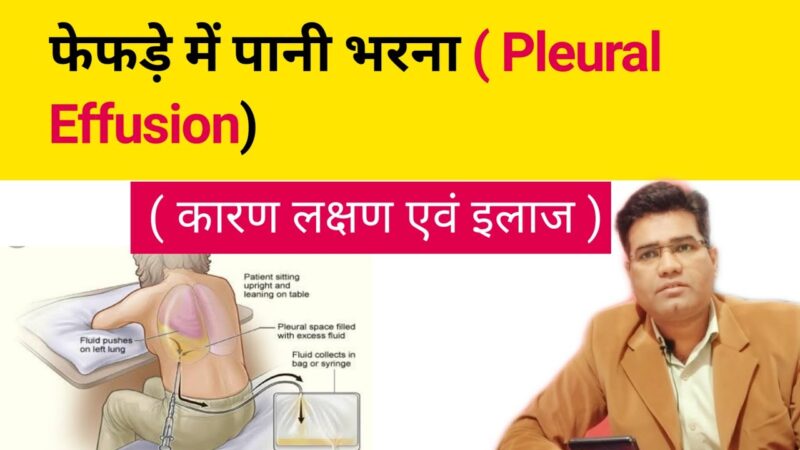 pleural effusion meaning in hindi - Hình 2