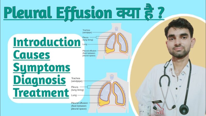 pleural effusion meaning in hindi - Hình 3
