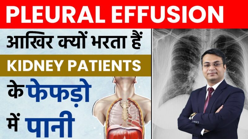 pleural effusion meaning in hindi - Hình 5