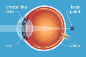 presbyopia meaning in hindi