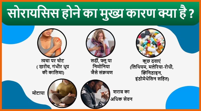 सोरायसिस का निदान: हिंदी में प्रक्रिया