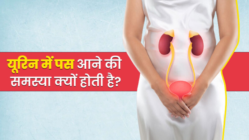 pus cells meaning in hindi - Hình 2