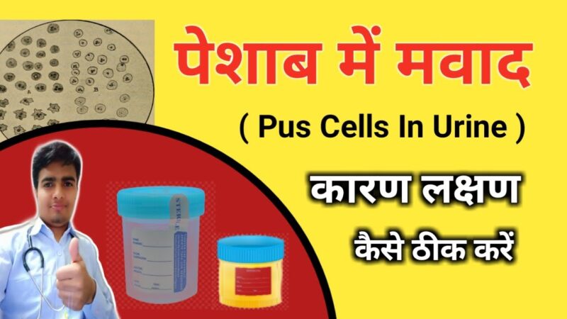 pus cells meaning in hindi - Hình 3