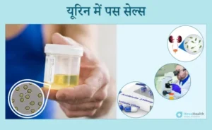 pus cells meaning in hindi