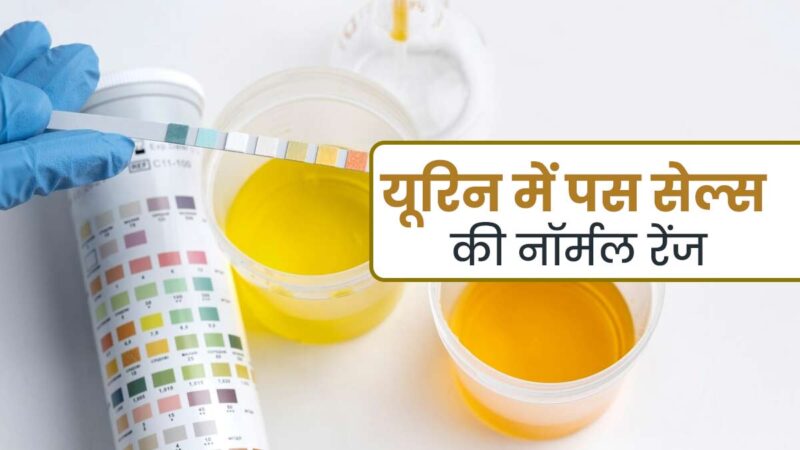 pus cells meaning in hindi - Hình 5