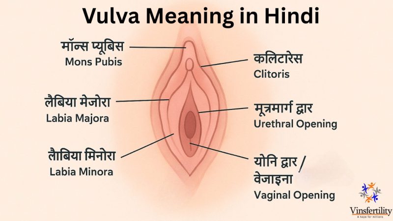 Reliever शब्द के विभिन्न हिंदी अर्थ और उनके उपयोग