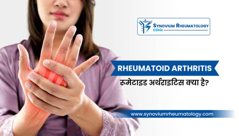 rheumatologist meaning in hindi - Hình 4