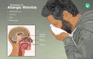 rhinitis meaning in hindi