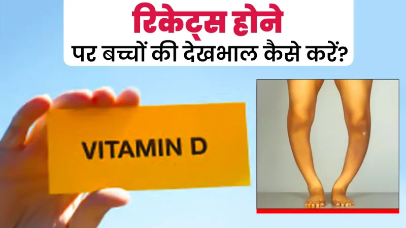 रिकेट्स के लक्षण और संकेत: बच्चों में इसकी पहचान कैसे करें