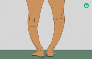 rickets meaning in hindi 4