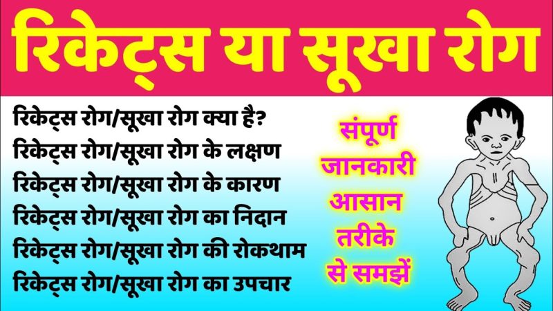 रिकेट्स की रोकथाम: जोखिम कम करने के लिए कदम