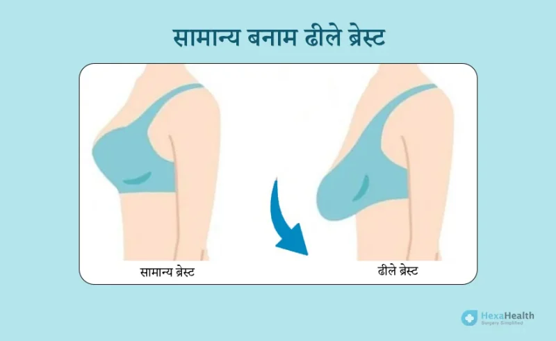 sagging meaning in hindi 2