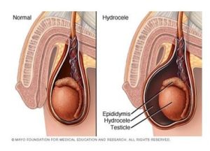 scrotum meaning in hindi 3
