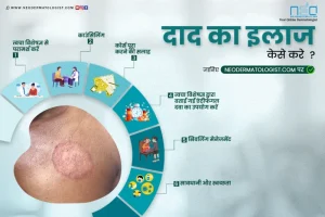 seizures meaning in hindi 4