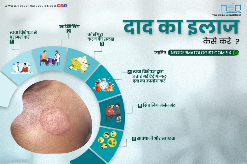 दौरे के दौरान क्या करें: प्राथमिक चिकित्सा और सुरक्षा उपाय