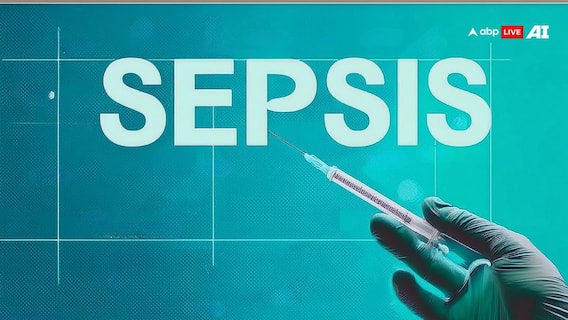 सेप्सिस के कारण और जोखिम कारक (Sepsis ke kaaran aur jokhim karak)