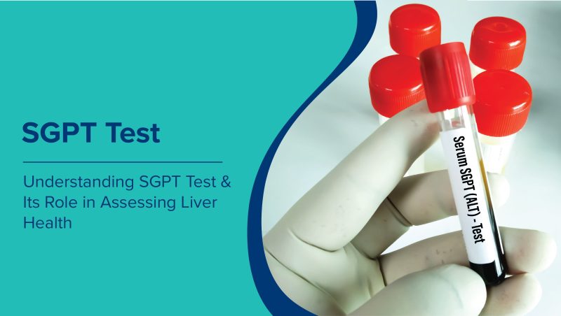 एसजीपीटी टेस्ट क्या है? (SGPT Test Kya Hai?)