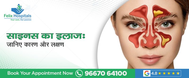 साइनसाइटिस के लक्षण: पहचान और निदान (Sinusitis ke lakshan: Pahchan aur nidan)