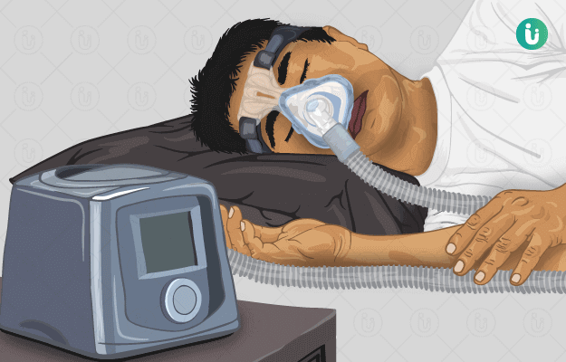 sleep apnea meaning in hindi - Hình 3