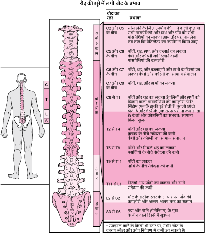स्पाइनल कॉर्ड के स्वास्थ्य को बनाए रखना: हिंदी में सुझाव और मार्गदर्शन
