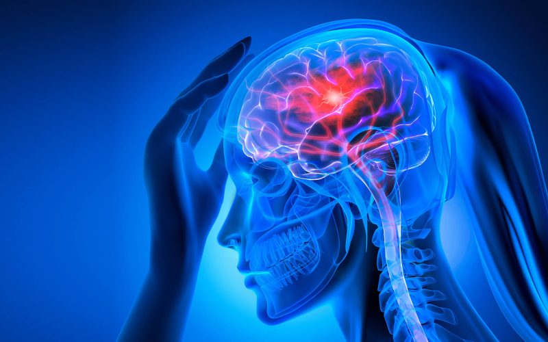 स्ट्रोक का निदान और उपचार (Stroke ka Nidan aur Upchar)
