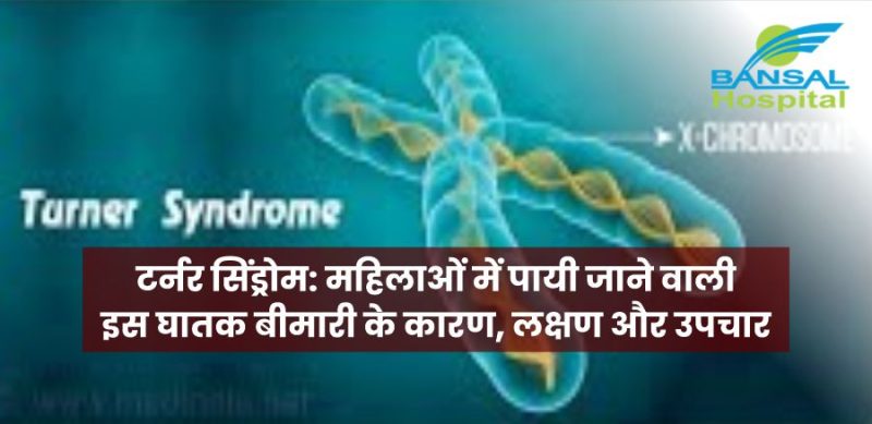 Syndrome Meaning In Hindi: संलक्षण क्या है? कारण, लक्षण, और विचार प्रक्रिया 12 सिंड्रोम का इलाज कैसे किया जाता है? सिंड्रोम के इलाज और लक्षणों को प्रबंधित करने के लिए उपचार विकल्प