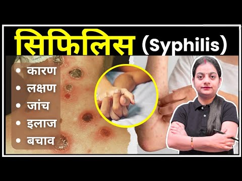 सिफिलिस क्या है? (Syphilis kya hai?)  सिफिलिस एक जीवाणु संक्रमण है जो यौन संपर्क से फैलता है। यहां हम आपको सिफिलिस की बुनियादी जानकारी देंगे।