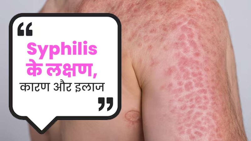 सिफिलिस के लक्षण: शुरुआती और बाद के चरण (Syphilis ke lakshan: shuruati aur baad ke charan)  सिफिलिस के लक्षणों को पहचानना महत्वपूर्ण है। हम आपको लक्षणों के विभिन्न चरणों के बारे में बताएंगे, ताकि आप समय पर कार्रवाई कर सकें।