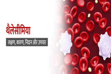 थैलेसीमिया के कारण और जोखिम कारक (Thalassemia Ke Karan Aur Jokhim Karak)