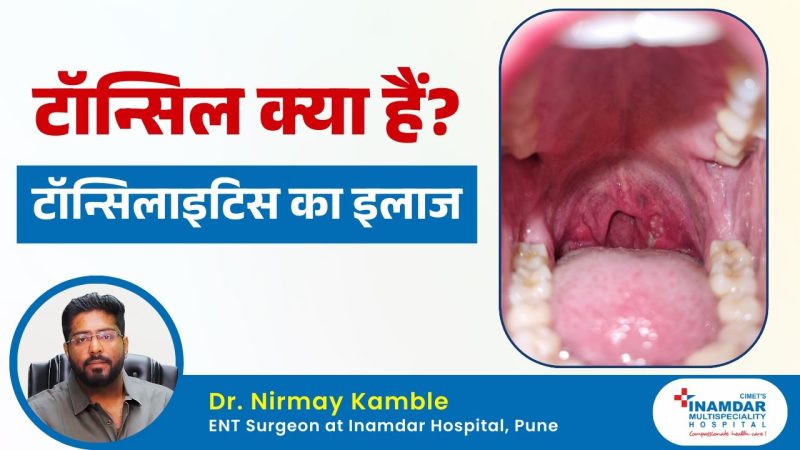 टॉन्सिल का हिंदी में अर्थ: परिभाषा और मूल बातें  टॉन्सिल शब्द का सटीक हिंदी अर्थ क्या है, इसकी परिभाषा और मानव शरीर में टॉन्सिल के महत्व को समझें।