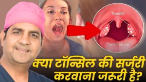 tonsil meaning in hindi 4