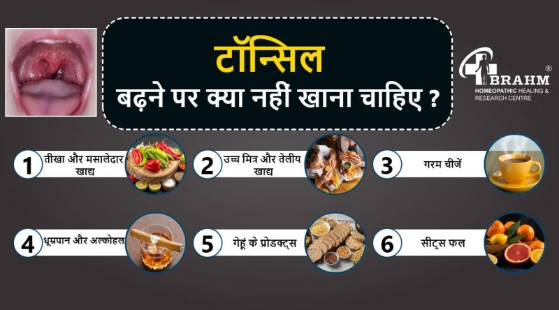 टॉन्सिल सर्जरी (टॉन्सिल्लेक्टोमी): हिंदी में प्रक्रिया, जोखिम और रिकवरी  टॉन्सिल सर्जरी कब आवश्यक होती है, प्रक्रिया कैसे की जाती है, जोखिम क्या हैं और रिकवरी प्रक्रिया कैसी होती है, इन सभी पहलुओं को हिंदी में समझें।