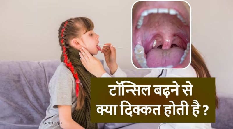 टॉन्सिल्स के कार्य: वे आपके शरीर के लिए क्यों महत्वपूर्ण हैं?