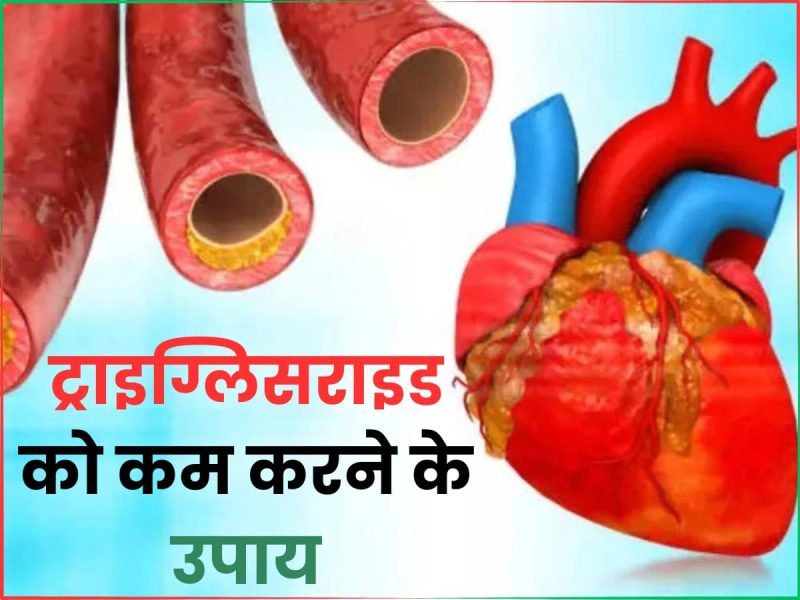 उच्च ट्राइग्लिसराइड्स के कारण (Ucch triglycerides ke karan)
