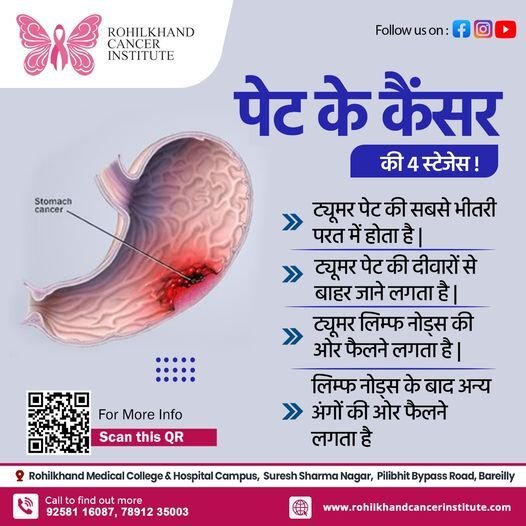 तपेदिक का हिंदी में अर्थ: एक व्यापक गाइड
