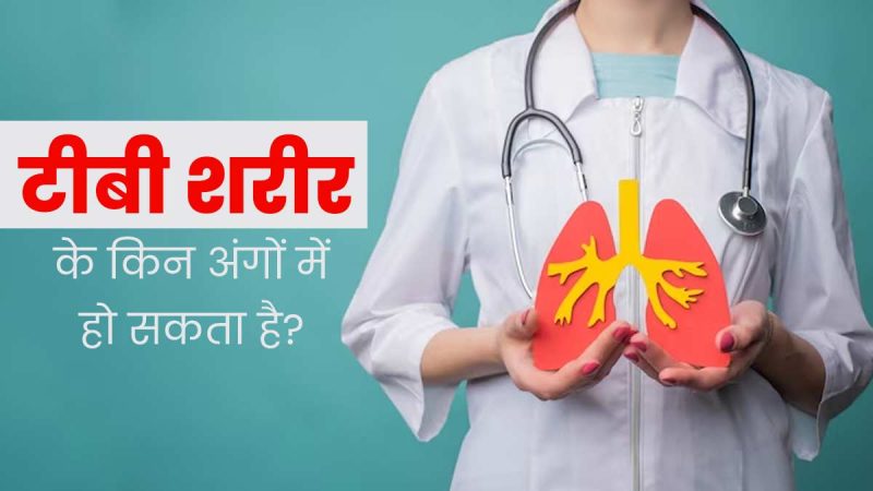 तपेदिक का इलाज: हिंदी में दवाएं और उपचार योजना