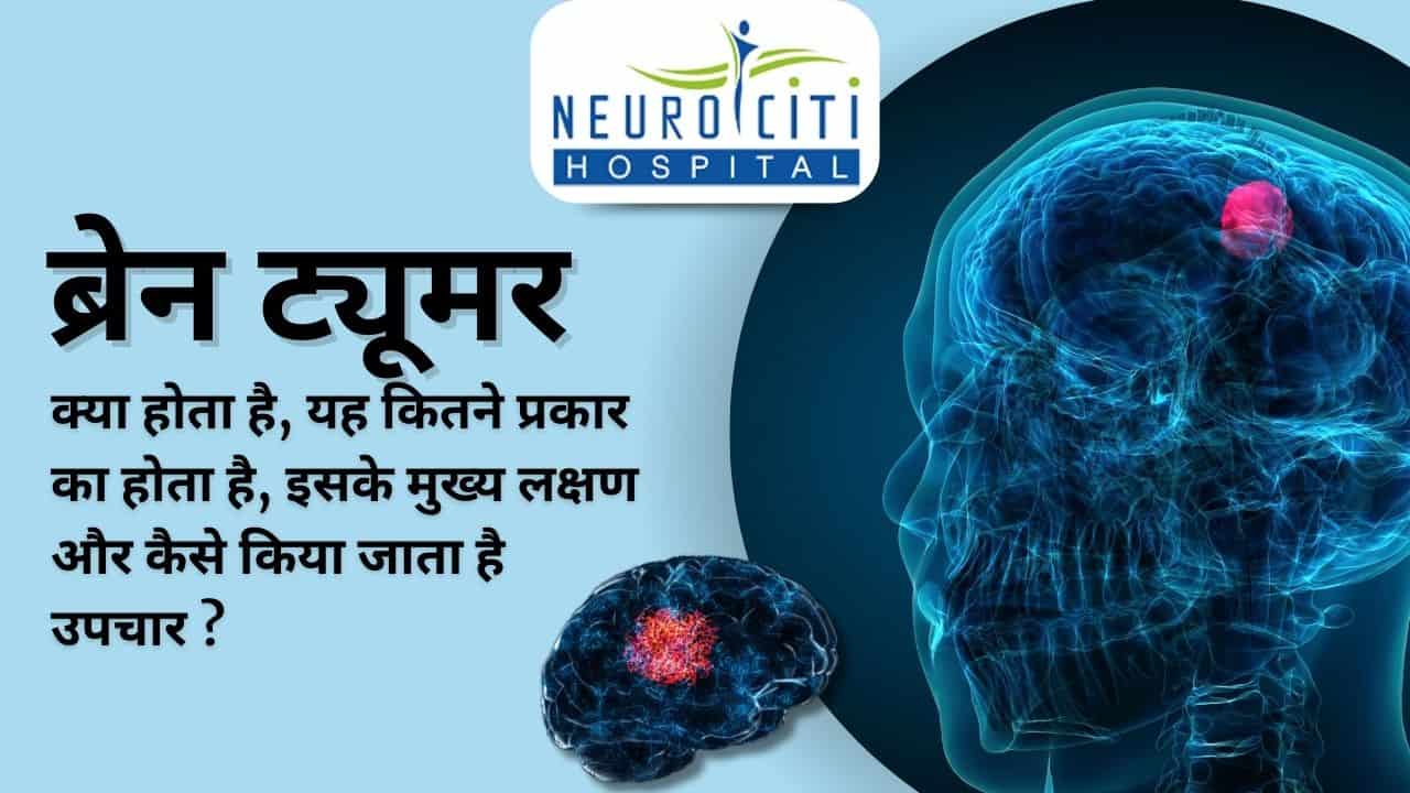 ट्यूमर के कारण: हिंदी में समझें