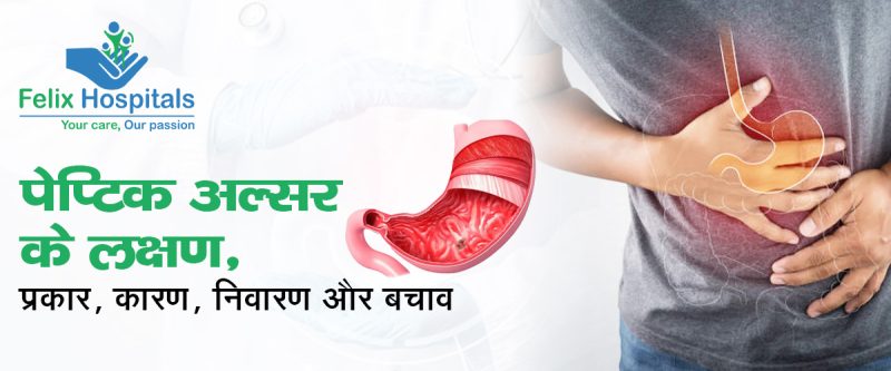 अल्सर के निदान के लिए विभिन्न प्रकार के परीक्षण