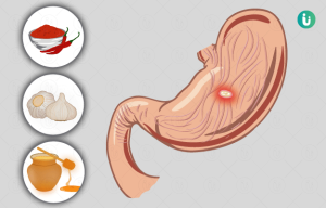 ulcers meaning in hindi 5