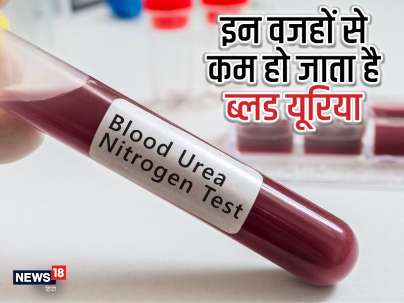 urea meaning in hindi - Hình 4