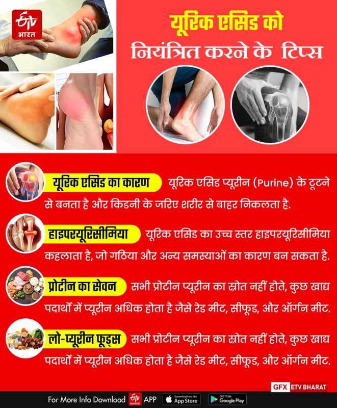 उच्च यूरिक एसिड (हाइपरयूरिसीमिया) क्या है?