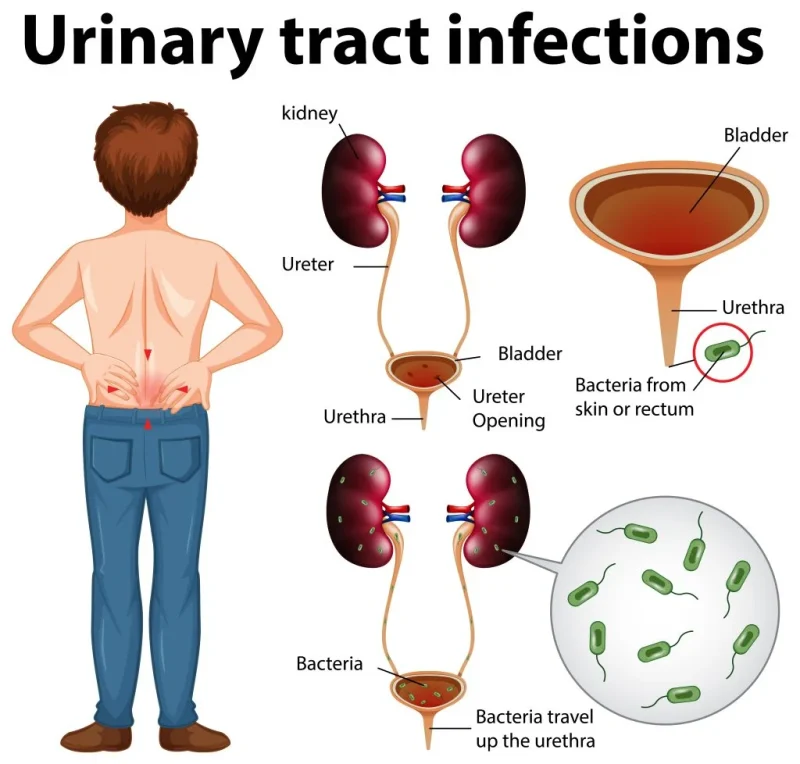 urine meaning in hindi - Hình 3