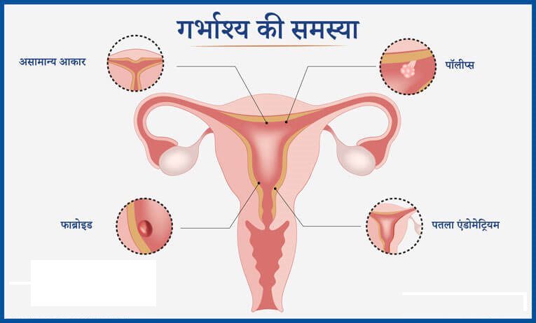 गर्भाशय के लिए सामान्य हिंदी शब्द (Garbhashay ke liye samanya hindi shabd)