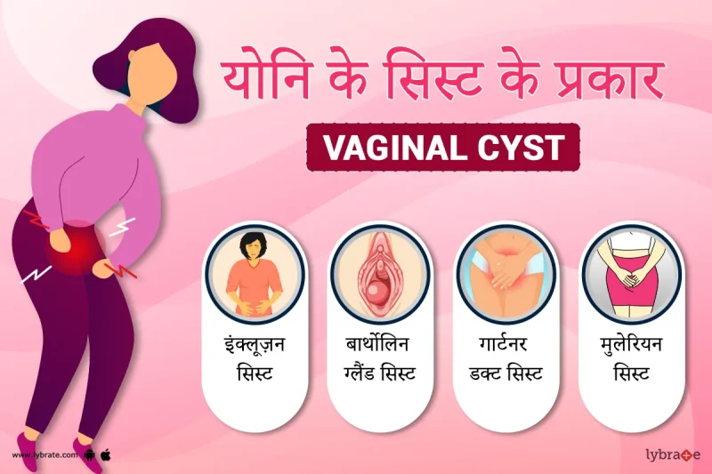 योनि का हिंदी में अर्थ: एक व्यापक परिभाषा
