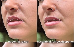 vertical lips meaning in hindi 4