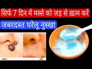 warts meaning in hindi 3